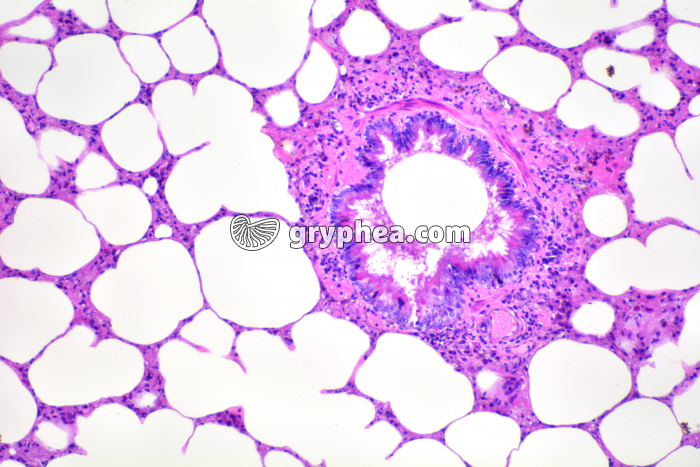 Poumon Homme sain x25 - gryphea.org